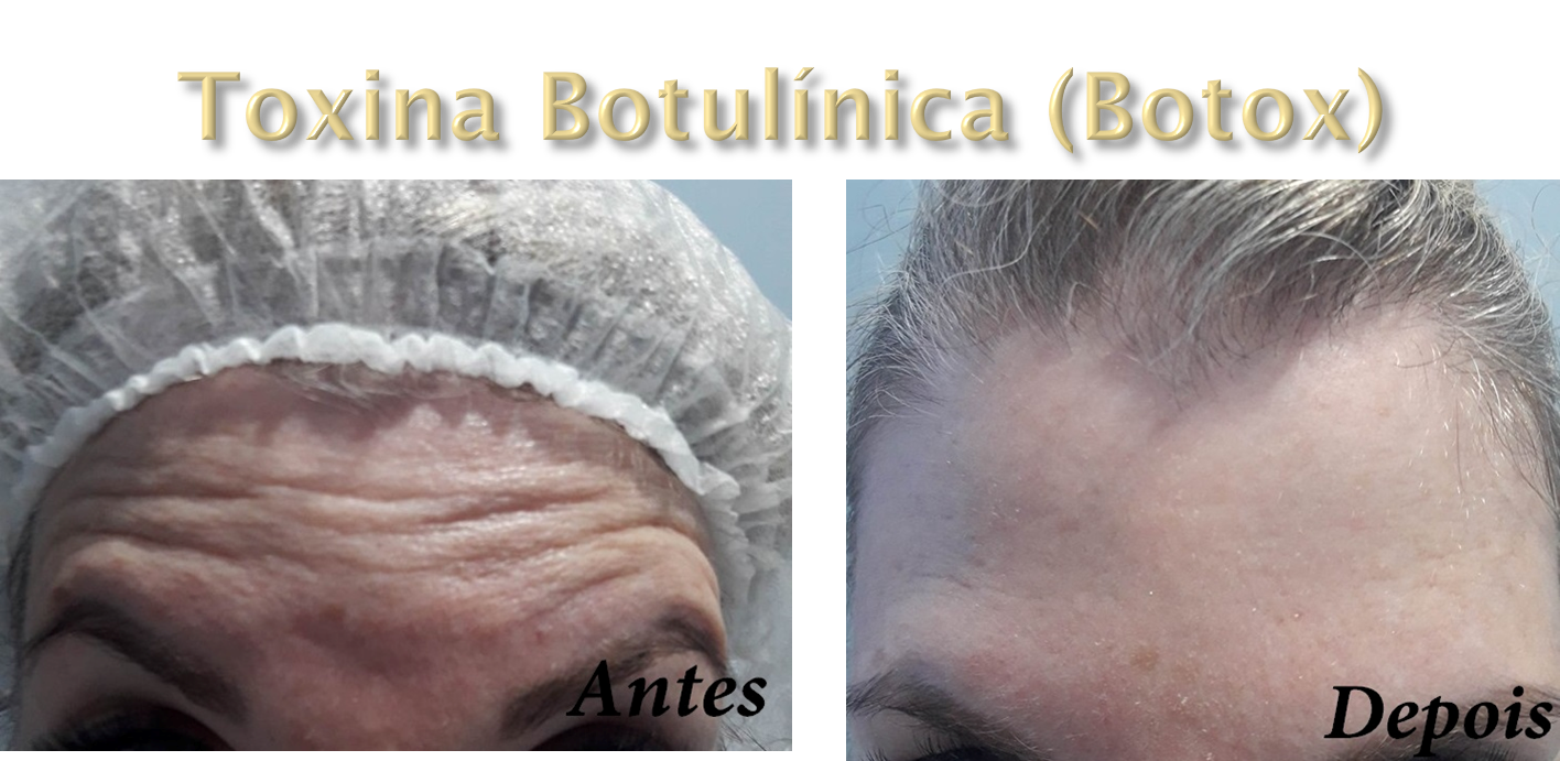 Clinica Estética Esteio/RS