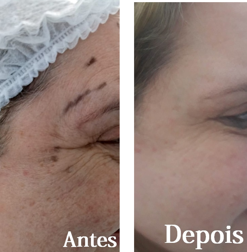 Clinica Estética Esteio/RS