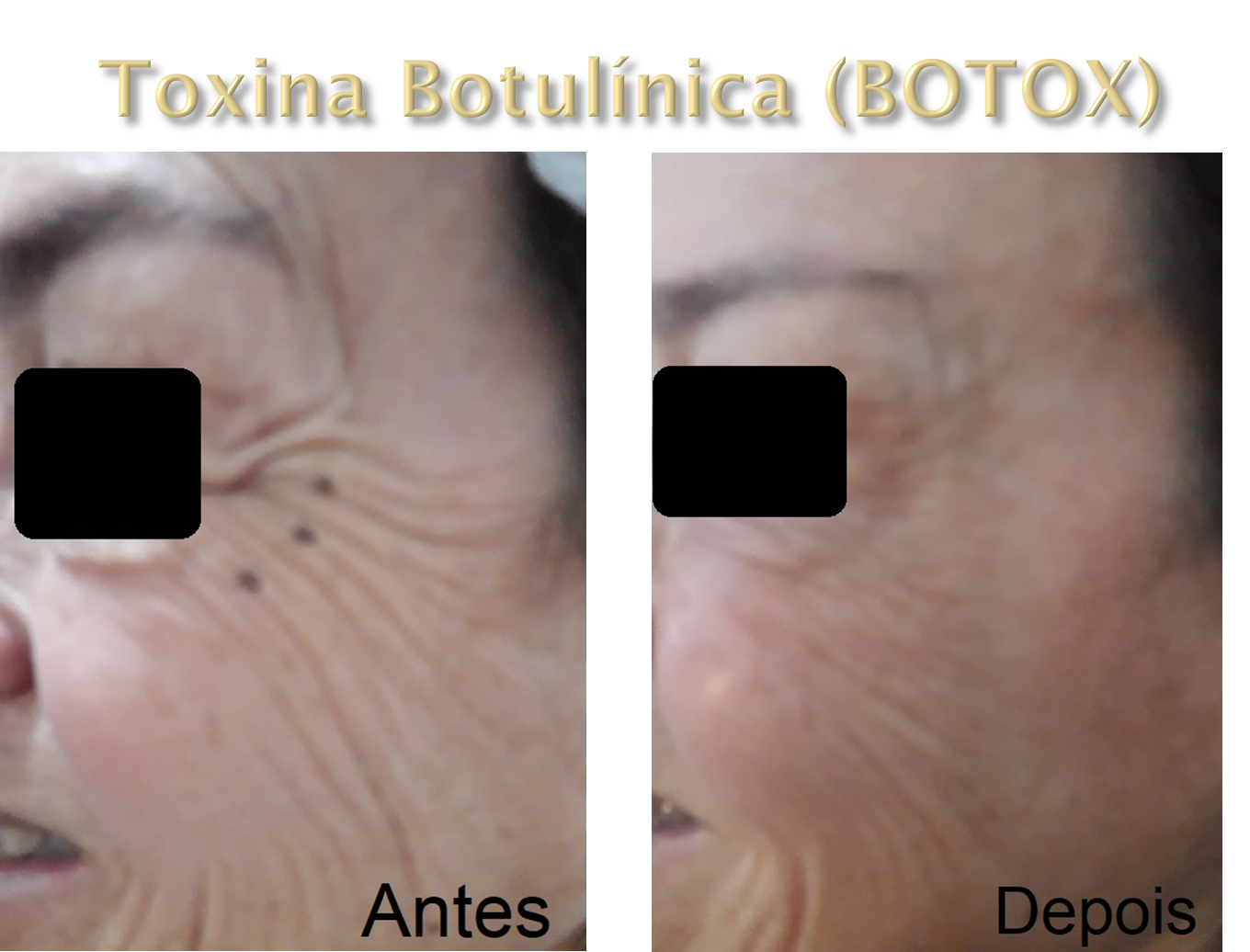 Clinica Estética Esteio/RS