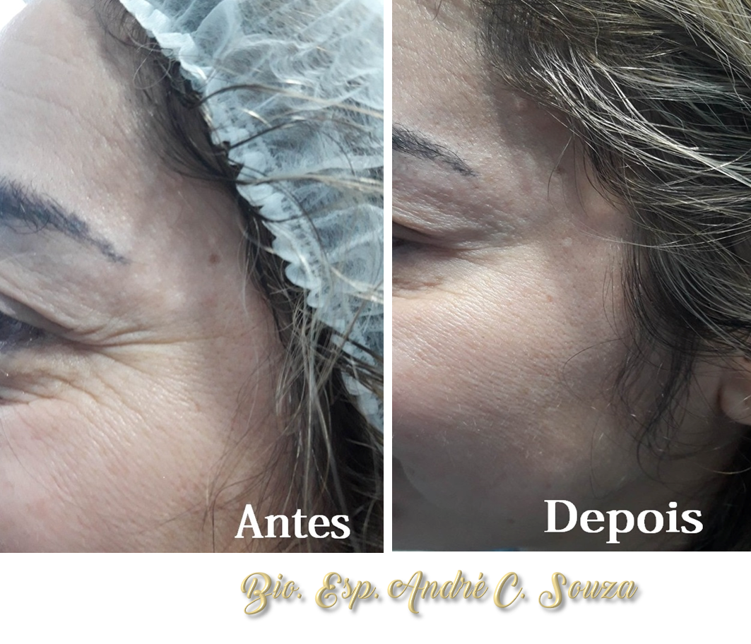 Clinica Estética Esteio/RS