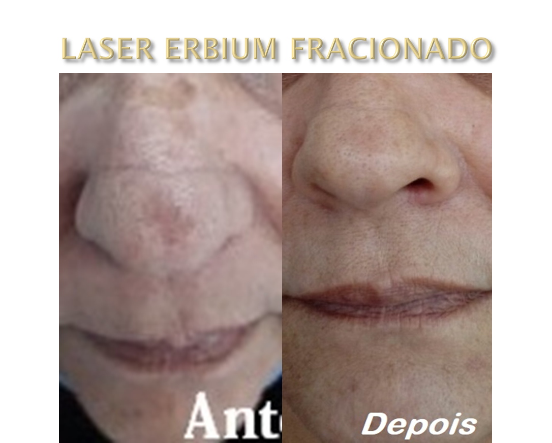 Clinica Estética Esteio/RS
