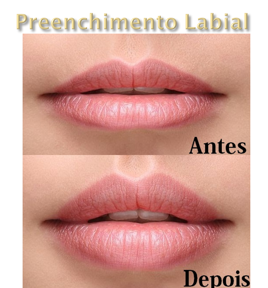 Clinica Estética Esteio/RS