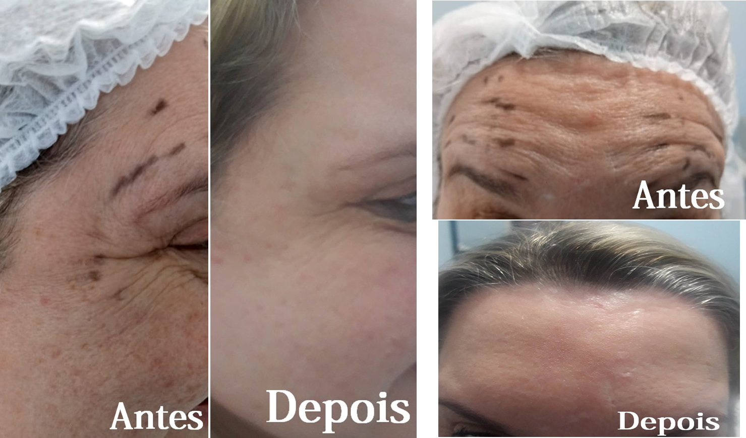 Clinica Estética Esteio/RS