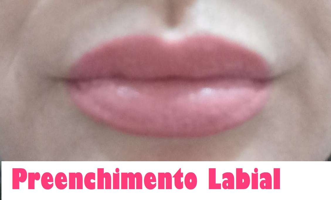 Clinica Estética Esteio/RS