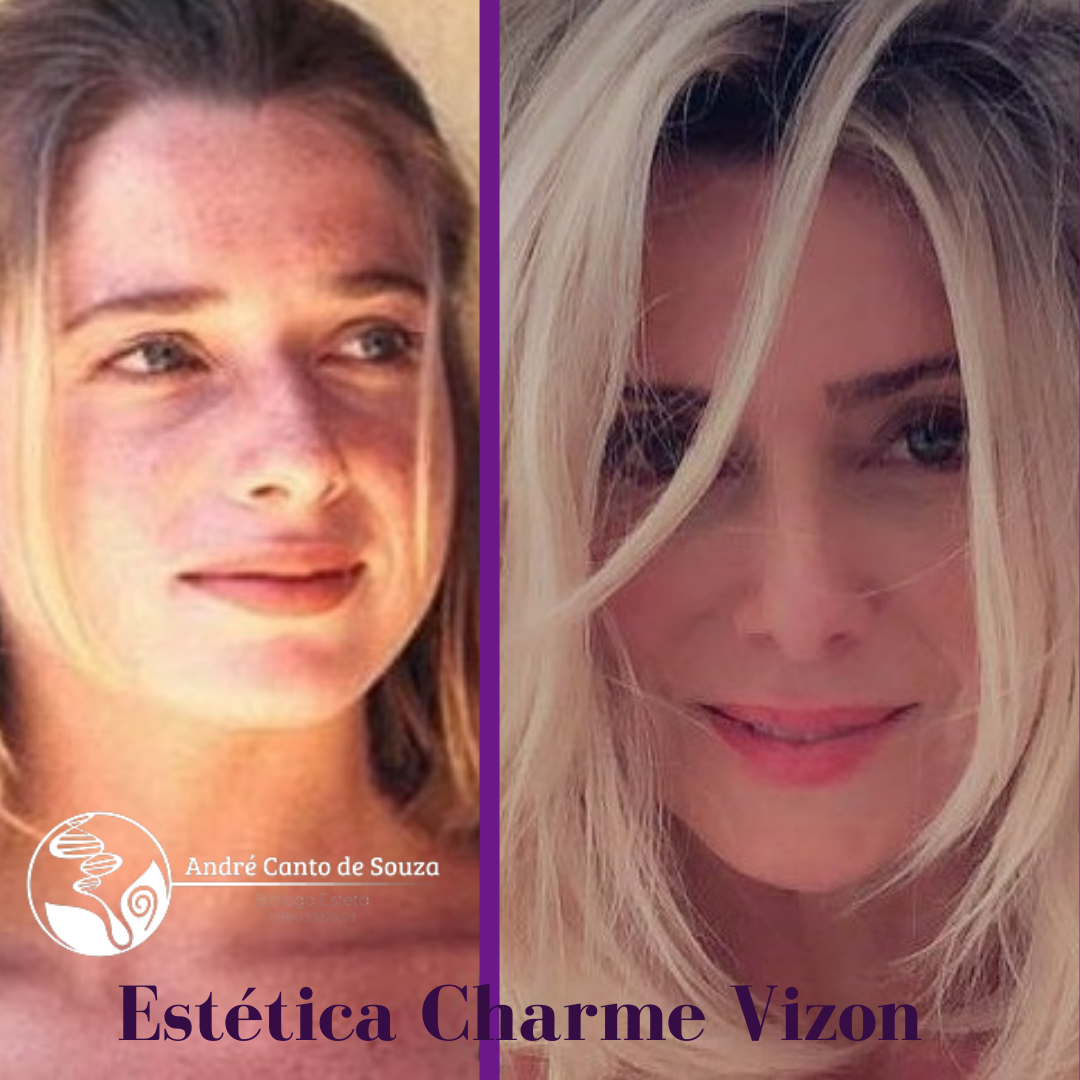 Clinica Estética Esteio/RS